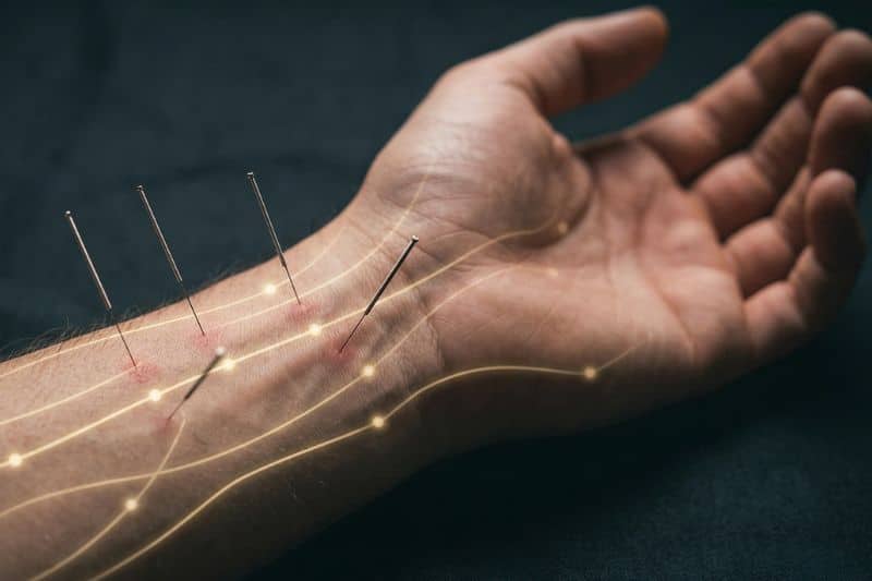 Agujas en el antebrazo cercanas al meridiano de pericardio para compensar problemas digestivos con acupuntura equilibrio de Tan